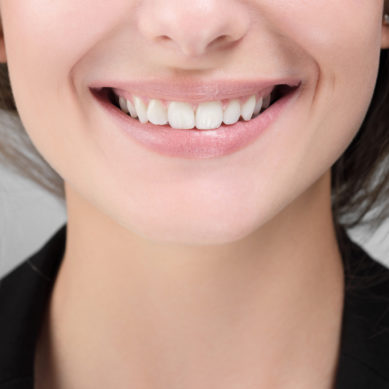 Jak wybielać zęby i nie uszkodzić szkliwa?